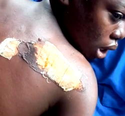 My father, stepmother attacked me with hot knife – 14-yr-old girl reveals
