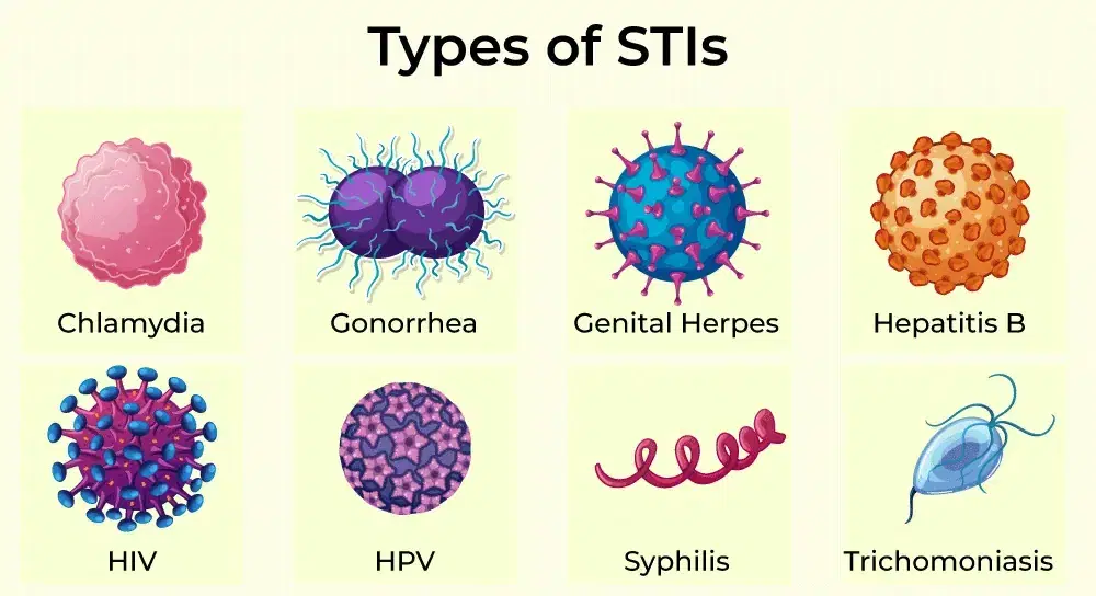 sti