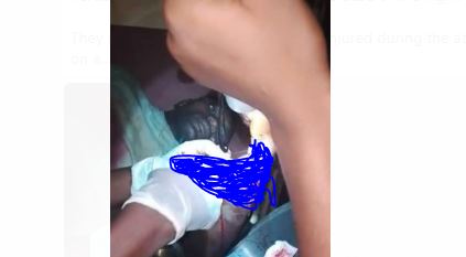 Ondo Killings: Survivors narrate ordeals