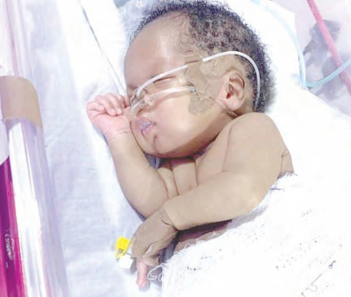 A cry for 2-yr-old Nadir: ‘Help me save my son’s heart’