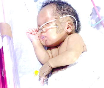 A cry for 2-yr-old Nadir: ‘Help me save my son’s heart’
