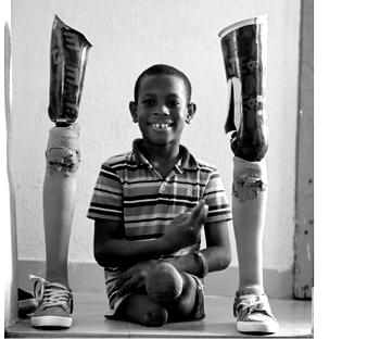 Michael Alagba, 13-yr-old amputee challenges disability stigma with 2km walk