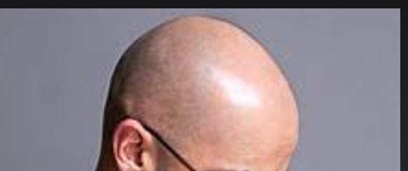 Why women are more attracted to bald men
