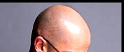 Why women are more attracted to bald men