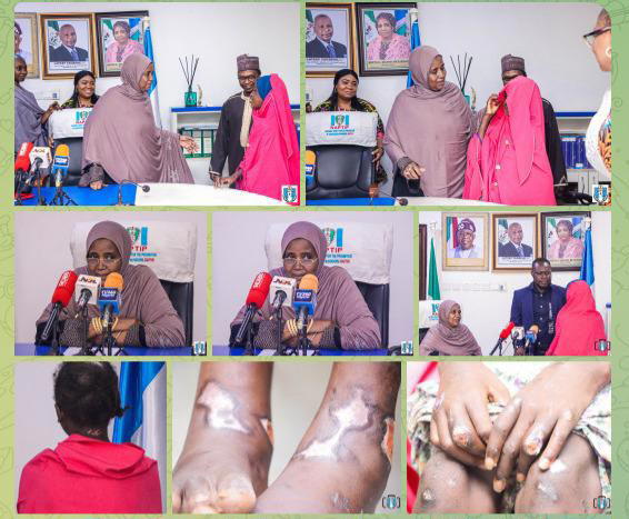 Brutalised teenager in Sokoto