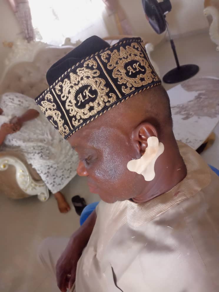 ‘Ear bitten, crown removed’ – Protest rocks Ondo over attack on monarch by community leader