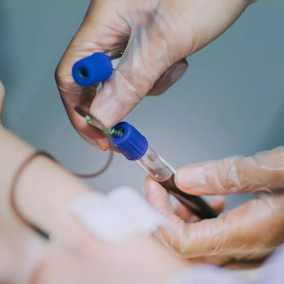 French scientists find new blood type in Guadeloupe woman