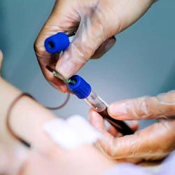 French scientists find new blood type in Guadeloupe woman