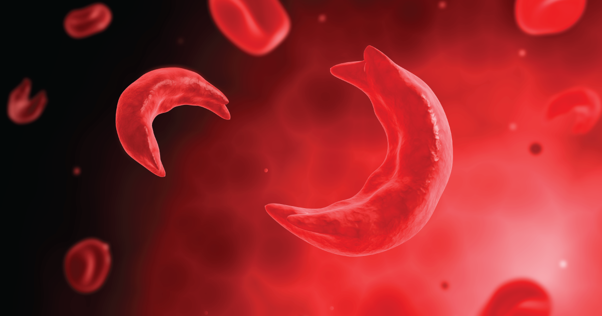 Nigeria grapples with 150,000 Sickle Cell cases annually – Harvard medical expert