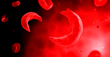 Sickle Cell crisis: Stakeholders demand urgent policy action