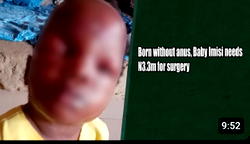 Born without anus, Baby Imisi needs N3.3m for surgery
