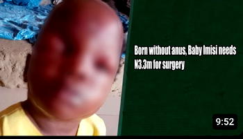 Born without anus, Baby Imisi needs N3.3m for surgery