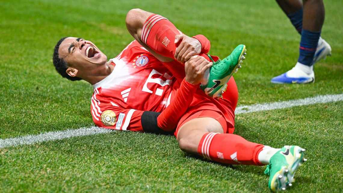 Bayern’s Musiala out for ‘long period’ with broken fibula
