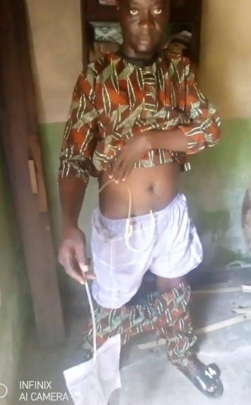 14 years of pain: House painter seeks N1.2m for life-changing surgery