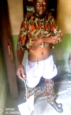 14 years of pain: House painter seeks N1.2m for life-changing surgery