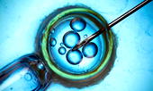 UK delivers 8 babies using groundbreaking ‘3-parent’ IVF 