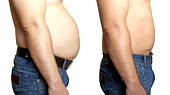 Study finds tummy-tuck patients still losing weight five years after