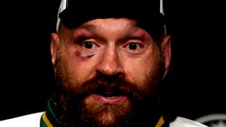 Tyson Fury returns to boxing 12 months after retirement