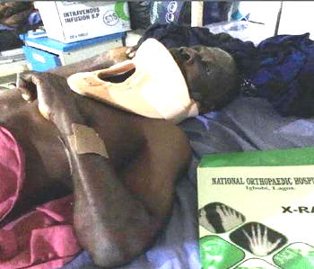 Spinal cord injury patient seeks N3.5m for life-saving surgery