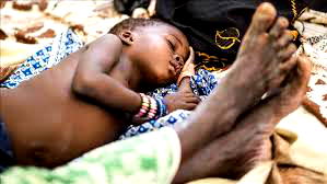 A child’s cry: Nigeria’s malnutrition crisis demands urgent action