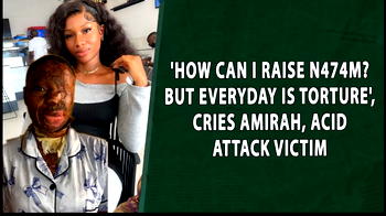 VIDEO: ‘How can I raise N474m? But everyday is torture’, cries Amirah, acid attack victim