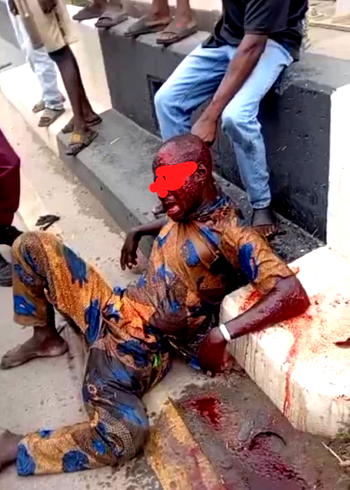 LASTMA nabs Togolese driver after speed-Induced crash on Lagos Island