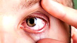 24m Nigerians suffer sight loss, says Prof Uneke