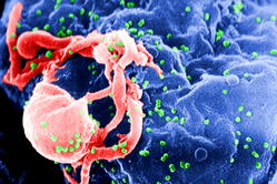Adamawa records 8,850 new HIV infections in 4 years – Official