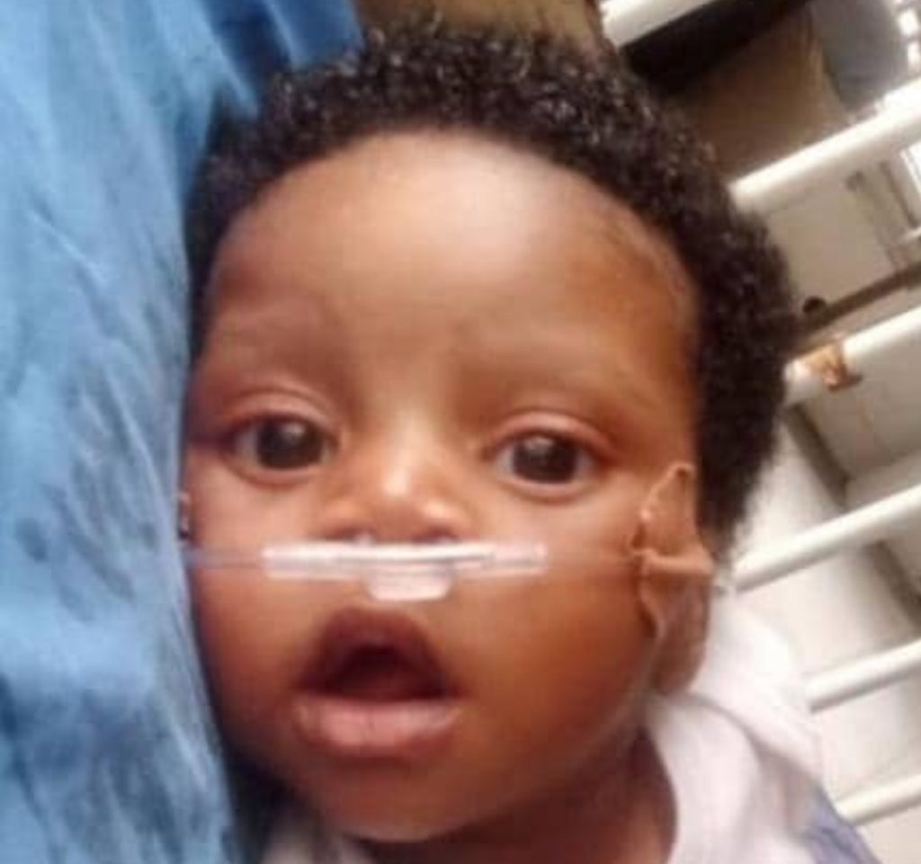 4-month-old Araoluwa Sopade needs N11.9m for urgent Ventricular Septal Defect (VSD) treatment