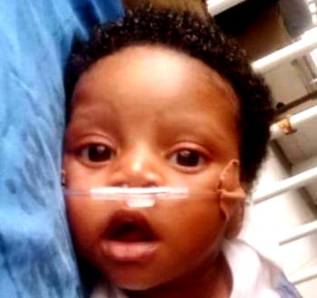 4-month-old Araoluwa Sopade needs N11.9m for urgent Ventricular Septal Defect (VSD) treatment