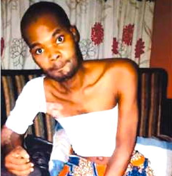 Man suffers broken jaw, hand, leg in electrocution accident while fixing billboard in Lagos 