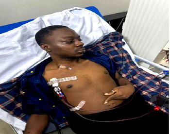 Kidney patient seeks N43m for urgent transplant