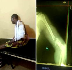 Immigration officer allegedly shoots woman in Badagry community