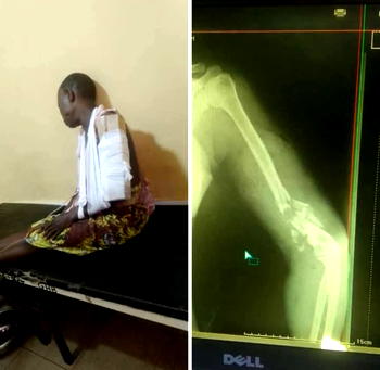 Immigration officer allegedly shoots woman in Badagry community
