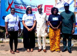 We’re determined to combat sickle cell disease in Niger Delta region – MD, NDDC