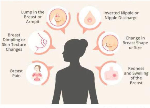 Breast cancer: Personalised screening better than annual mamograms — Study