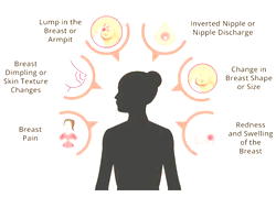 Breast cancer: Personalised screening better than annual mammograms’ — Study