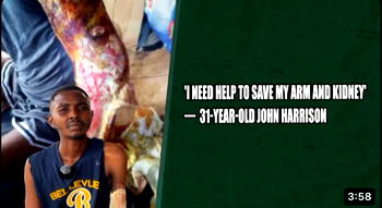 ‘I Need Help To Save My Arm And Kidney’ — 31 Year Old John Harrison