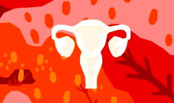 Turning targets into tangible impact: Nigeria’s cervical cancer strategy for 2030