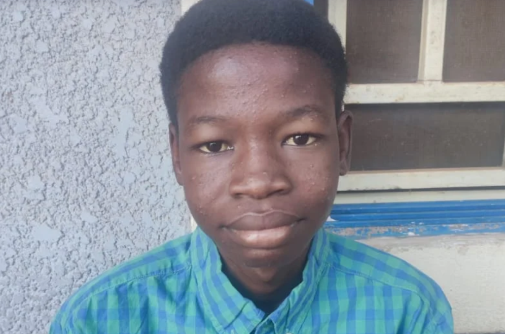 Unusual story of Gombe varsity student who lives on liquids for 21 years