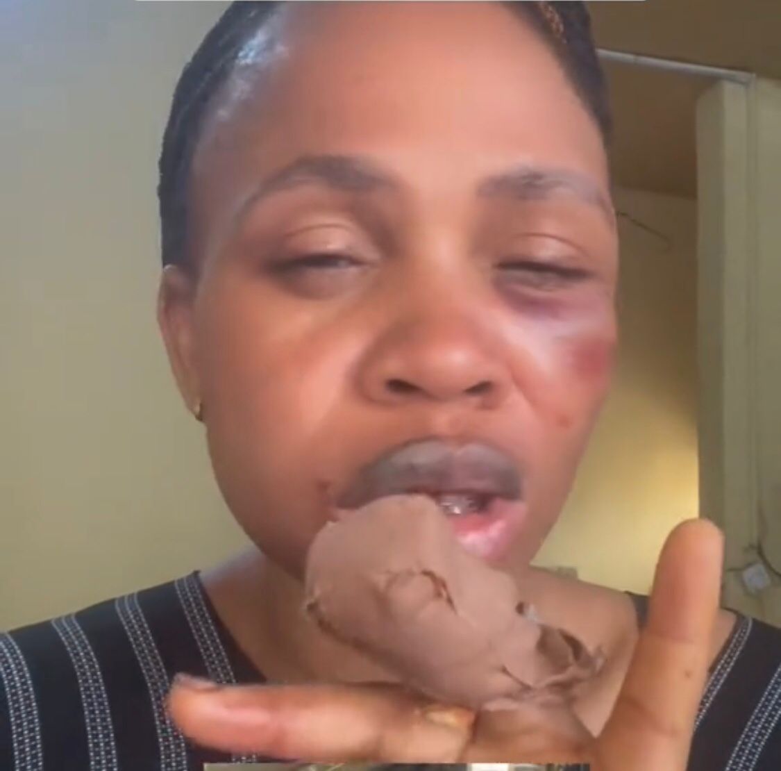 Man arrested for cutting off ex-lover’s finger in Lagos