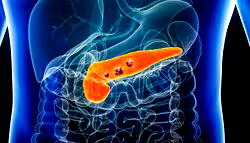 New drugs raise hopes of pancreatic cancer breakthrough