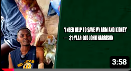 ‘I Need Help To Save My Arm And Kidney’ — 31 Year Old John Harrison