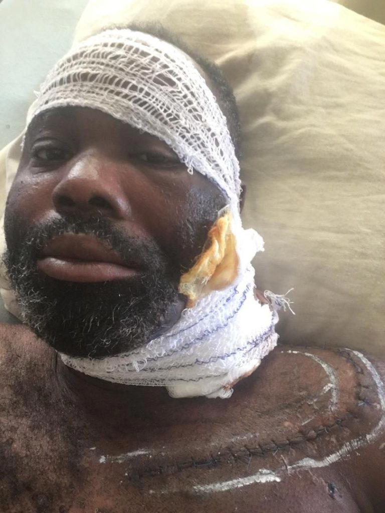 Threatened with homelessness, visually impaired Ayoola appeals for N15.2m rescue to restore vision