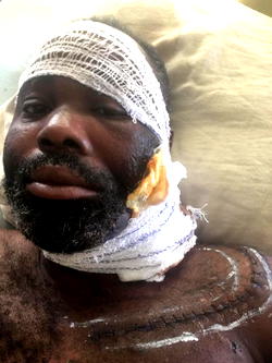 Facing eviction, blind Ayoola seeks N15.2m lifeline to regain sight