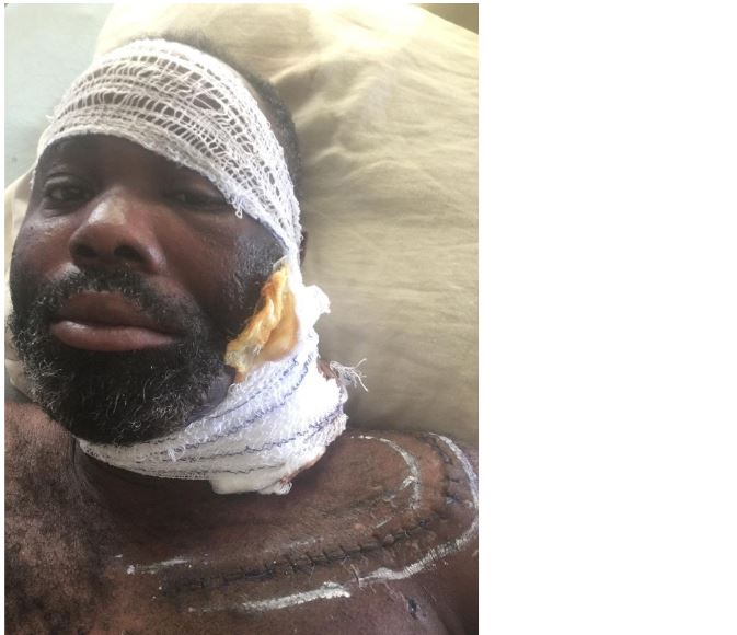 Facing eviction, blind Ayoola seeks N15.2m lifeline to regain sight