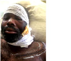 Facing eviction, blind Ayoola seeks N15.2m lifeline to regain sight