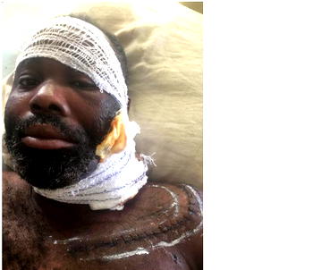 Facing eviction, blind Ayoola seeks N15.2m lifeline to regain sight