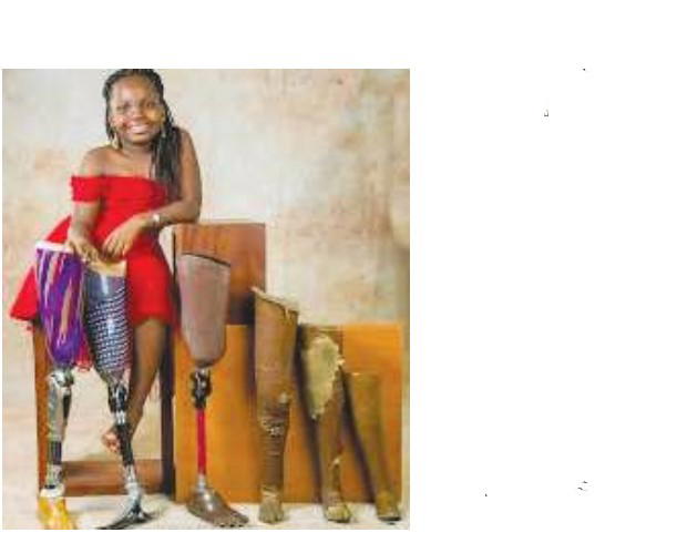 Beulah: Restoring hope to child-amputees, driving inclusive education