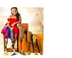 Beulah: Restoring hope to child-amputees, driving inclusive education